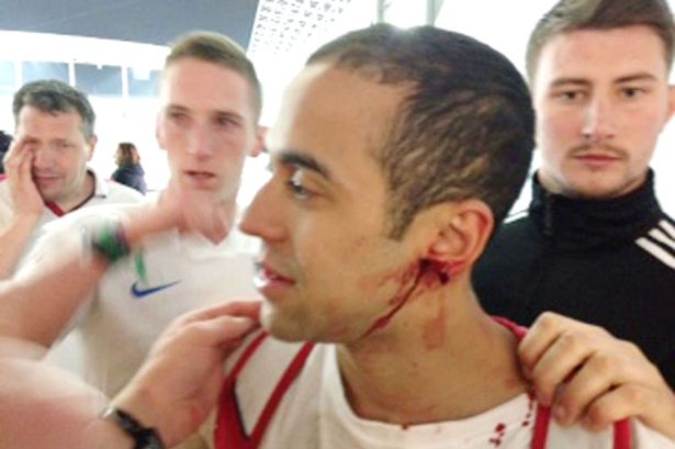 England-fan-attacked-during-football-match-in-Brazil