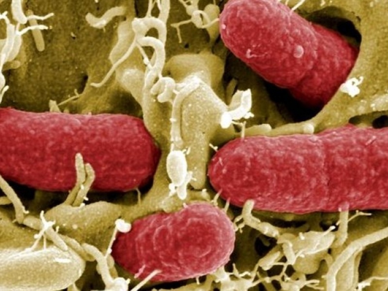 Άρης Vs Έρις