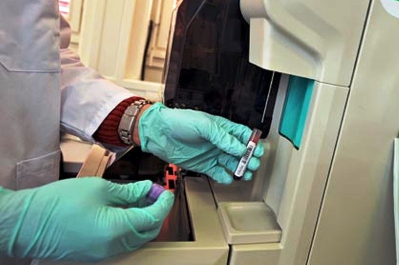 Πίεση κογκρέσου σε NFL