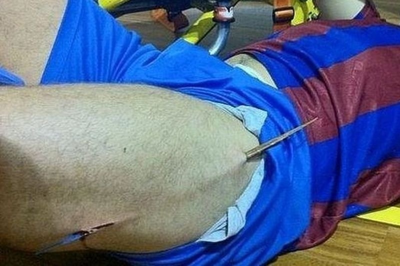 Τραυματισμός – σοκ παίκτη της Βαρκελώνης