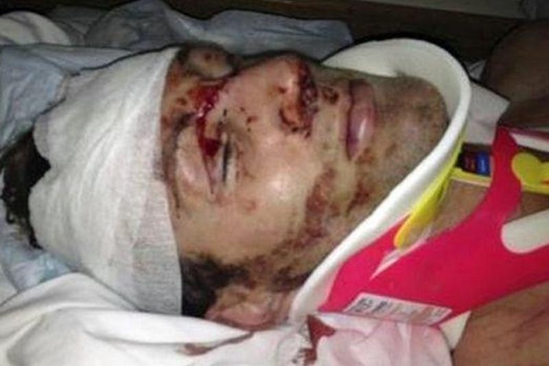 Έφαγε ξύλο για ένα... τσιγάρο!