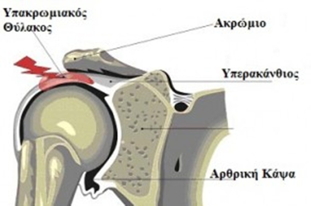 Επεμβατικές Τεχνικές στον Ώμο