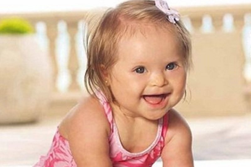 Κοριτσάκι με σύνδρομο Down πρωταγωνιστεί σε διαφημιστική καμπάνια