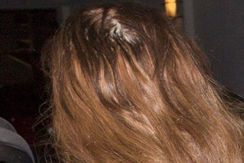 Σε ποια ανήκει ετούτη η καράφλα; Αποσύνθεση στο έπακρο!