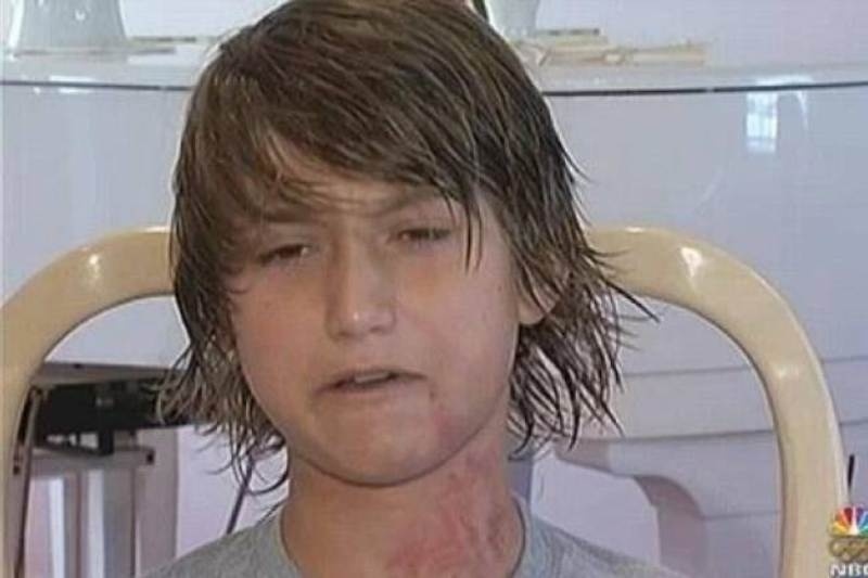 Το χτύπημα του περιστεριού