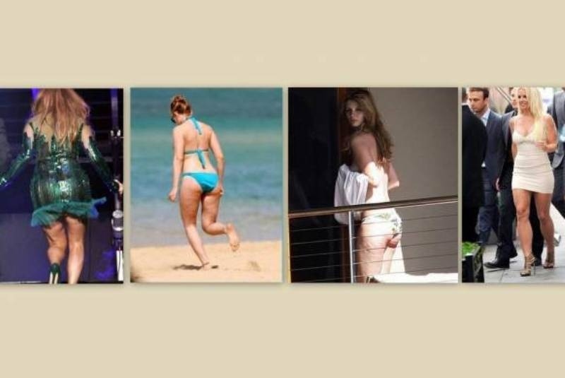 Έχουν και αυτές ατέλειες!