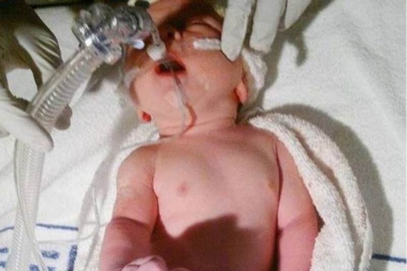 Απίστευτο: Κοριτσάκι ζει με την καρδιά στην δεξιά πλευρά