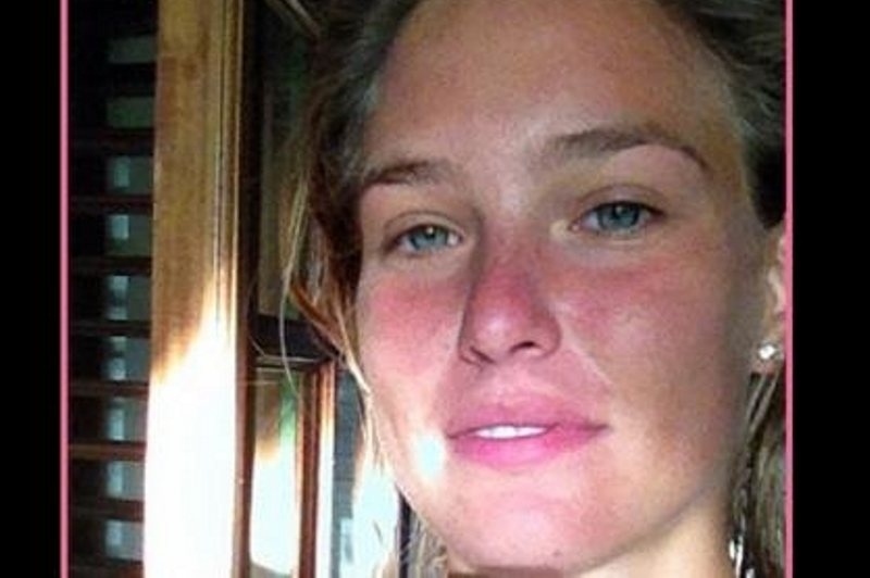 Με έγκαυμα στο πρόσωπο η Bar Refaeli