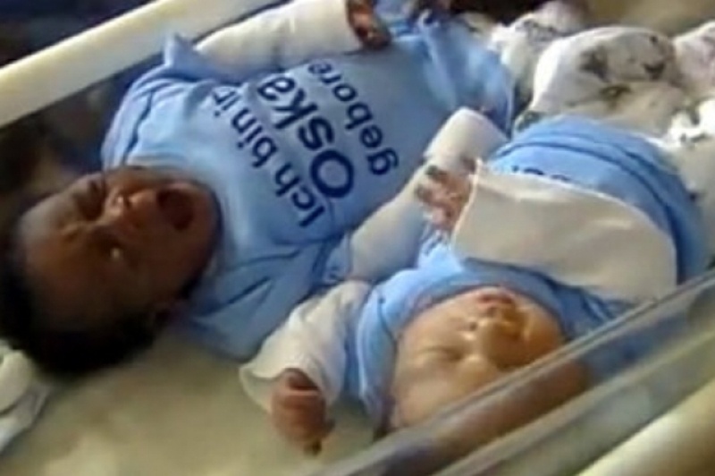 Βίντεο: Γέννησε δίδυμα αλλά δεν είχαν το ίδιο χρώμα δέρματος!