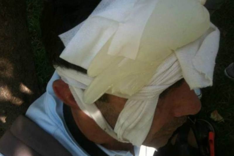 Τραυματίας δημοσιογράφος στο Σύνταγμα (φωτο)