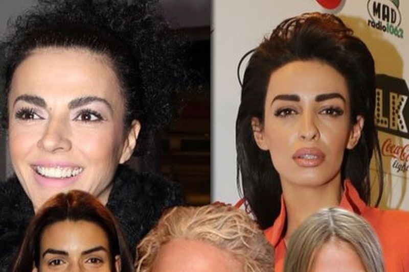 Τι συμβαίνει με τα φρύδια της showbiz;