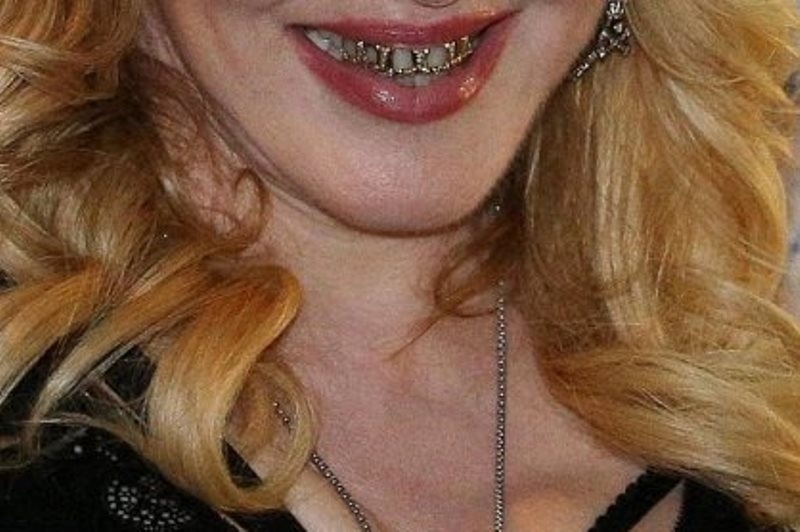 Χαμόγελο που… τρομάζει: Ποια ζάμπλουτη star γέμισε το στόμα της χρυσάφι;