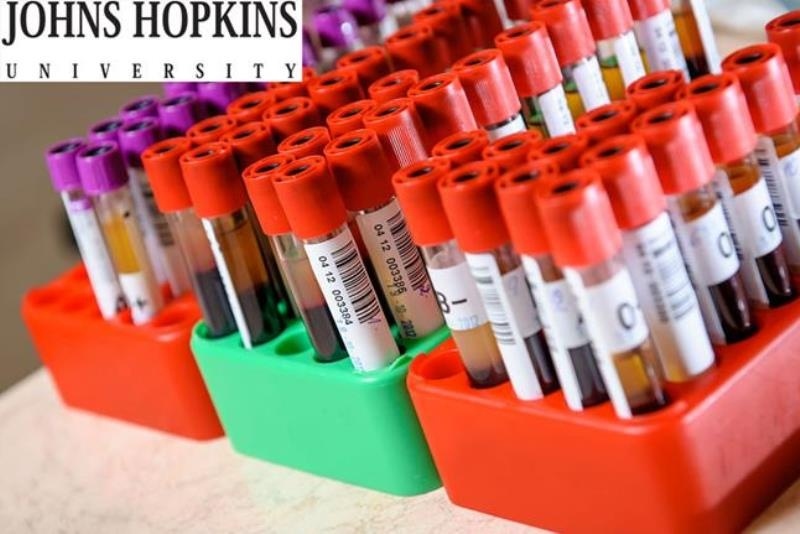 Πρωτοποριακή εξέταση αίματος εντοπίζει τον καρκίνο στο πάγκρεας