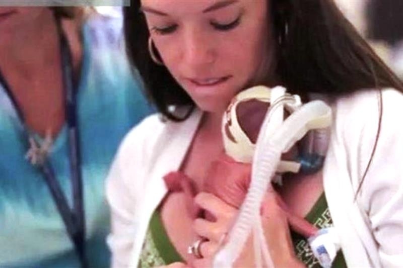 Το συγκλονιστικό video για την ανάπτυξη ενός πρόωρου μωρού