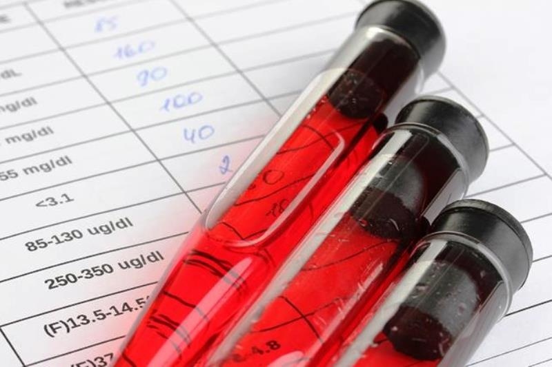 Εξέταση αίματος θα υπολογίζει το προσδόκιμο ζωής