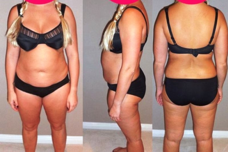 Ανάγκασε τον σύζυγο να την φωτογραφίσει έτσι για να χάσει τα κιλά εγκυμοσύνης