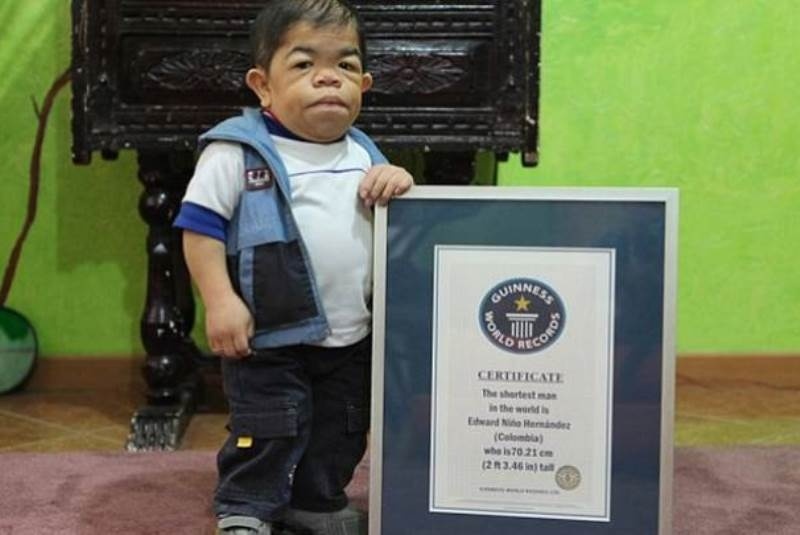 Η τραγική ιστορία ενός 28χρονου που ζει στο σώμα παιδιού (pics)