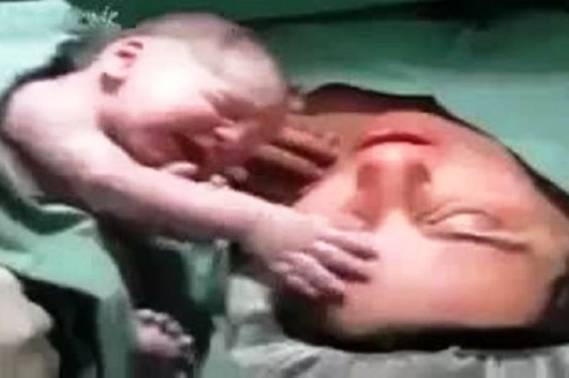 Το θαύμα της ζωής! Νεογέννητο δε θέλει να αποχωριστεί τη μαμά του!
