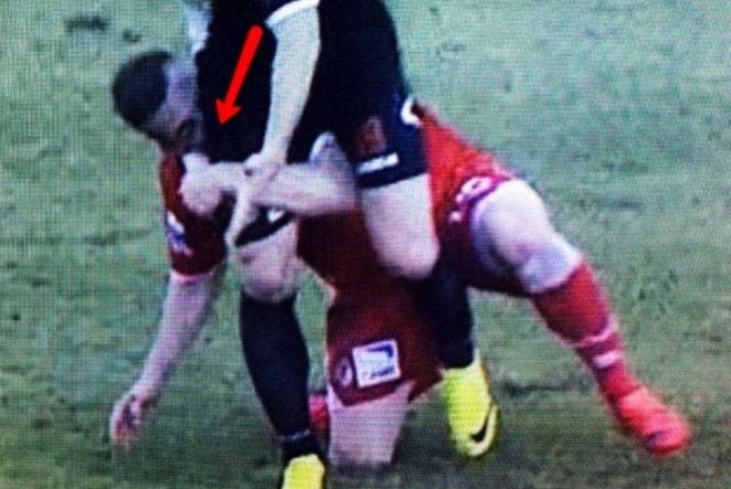 Ιταλία: Παίκτης την... είδε Σουάρες και δάγκωσε αντίπαλο! (video)