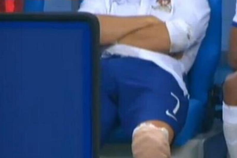 Κριστιάνο Ρονάλντο: Ο τραυματισμός με Γαλλία (photos+video)