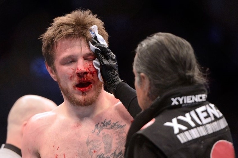 UFC Fight Night 63: Στα πιτς ο Dan Miller