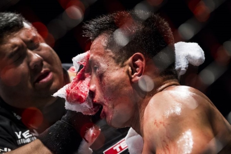 UFC: Μήνυση από πρώην μαχητές του!