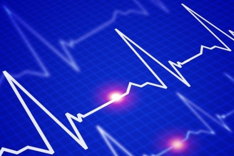 Έμφραγμα & εγκεφαλικό: Online τεστ δείχνει αν θα το πάθετε και πότε