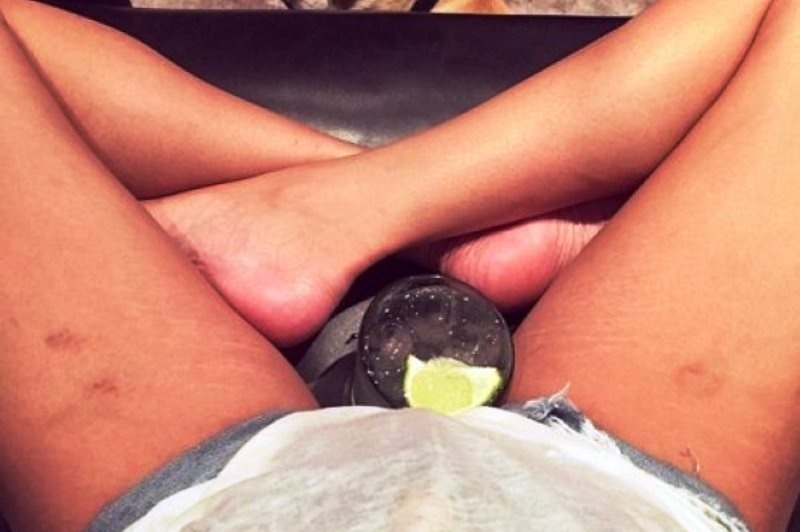 Το supermodel δείχνει τις ραγάδες τoυ και δίνει κουράγιο σε όλες εμάς