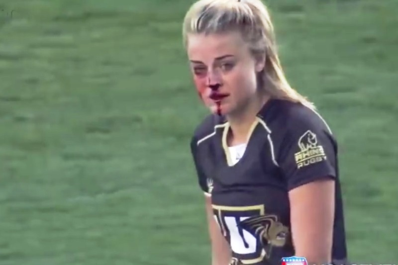 Της έσπασαν τη μύτη σε γυναικείο αγώνα ράγκμπι! (video)