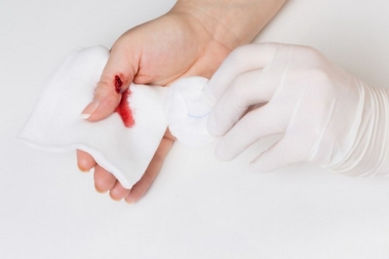 Οξυζενέ στην πληγή: Επιτρέπεται ή όχι;