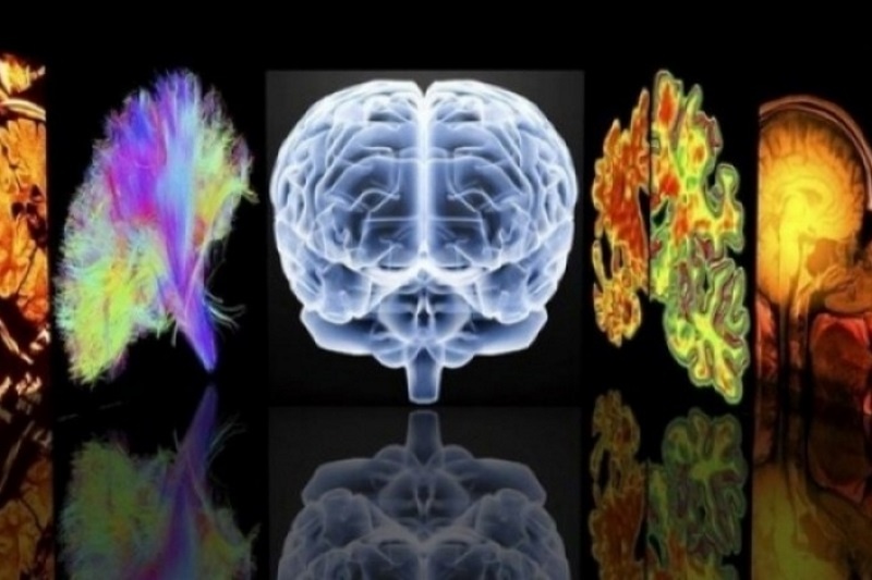 Ποιες είναι οι 3 μορφές Αλτσχάιμερ