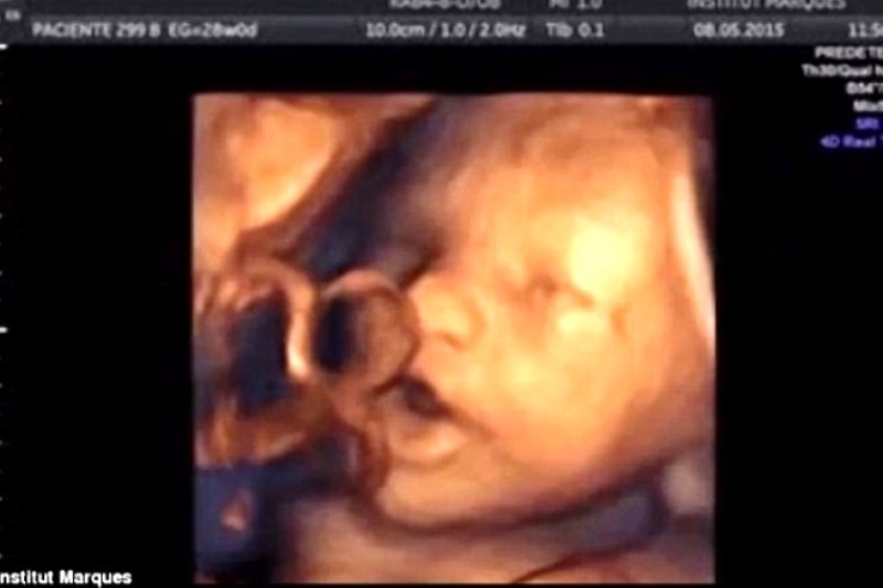 Απίστευτο βίντεο! Έμβρυο «τραγουδά» μέσα στη μήτρα!