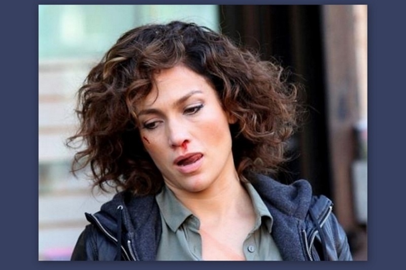 Το γύρο του διαδικτύου κάνει το μελανιασμένο πρόσωπο της Lopez