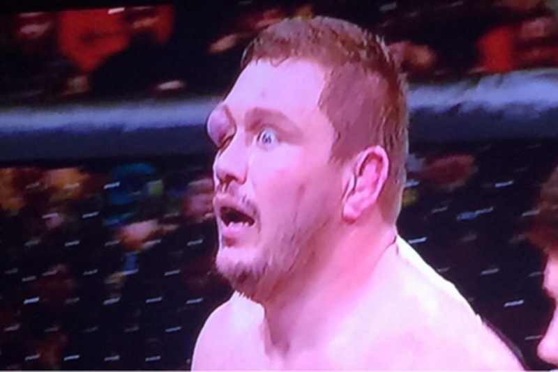 Τρομακτικός τραυματισμός στο UFC! (video)