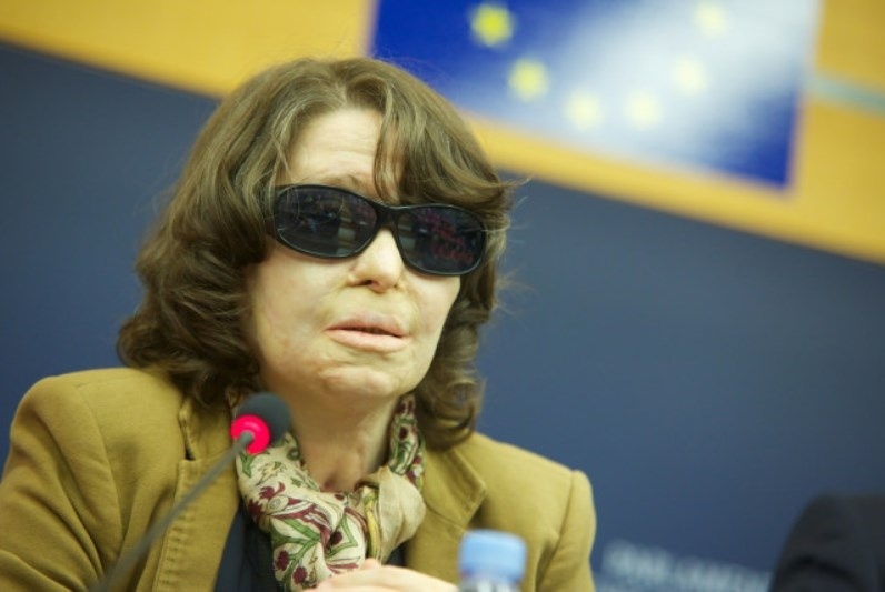 Στην Ελλάδα οι… Κούνεβες θα καίγονται πάντα με βιτριόλι!