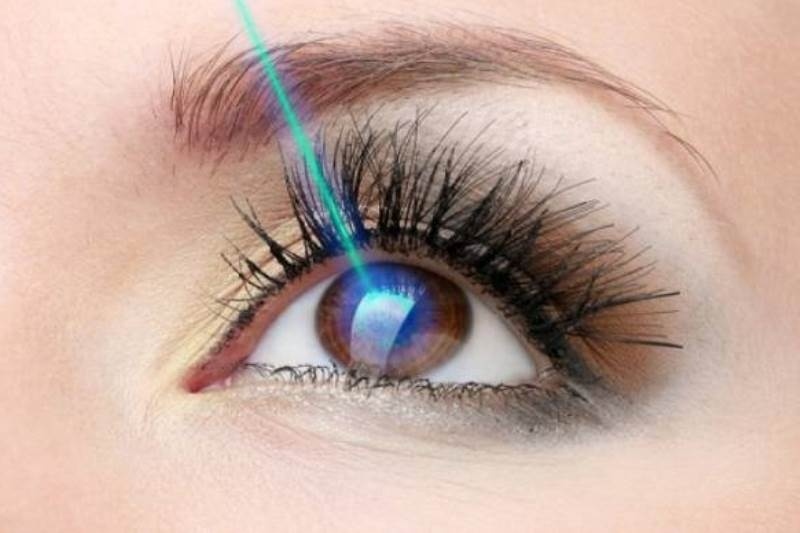 Laser στα μάτια: Πότε πρέπει να γίνεται, ποιοι δεν μπορούν να κάνουν
