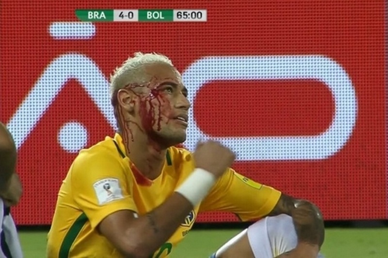 Έτσι μάτωσαν τον Νειμάρ (video)