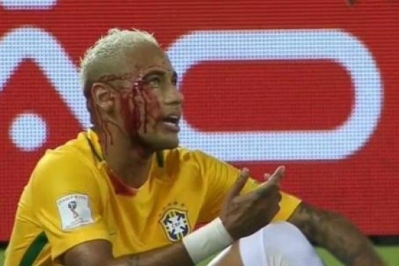 Και τον… μάτωσε και του την είπε!