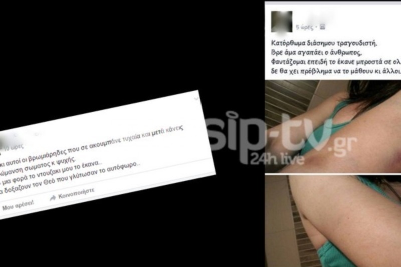 Καταγελία: Με ξυλοκόπησε Έλληνας τραγουδιστής (Εικόνες σοκ)