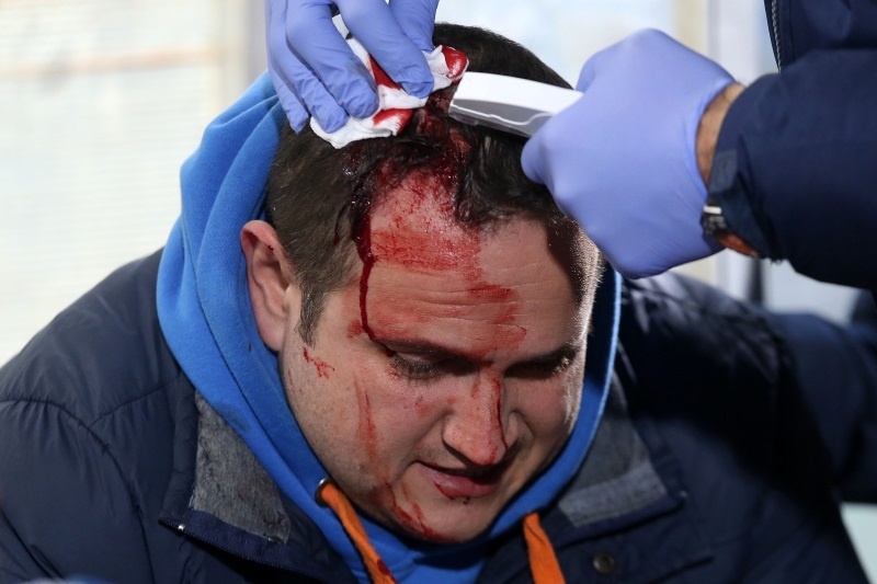 Σοκαριστικά video από τα άγρια επεισόδια στο Ηρακλής-ΠΑΣ Γιάννινα!