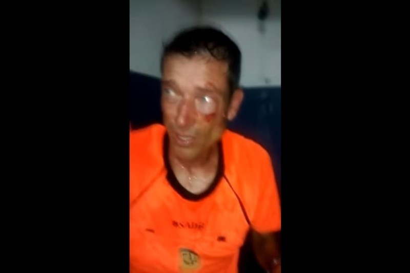 Αργεντινή: Άγριο ξύλο σε διαιτητή (videos)