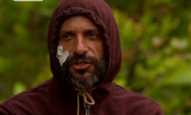 Survivor: Τι έπαθε στο πρόσωπό του ο Χρανιώτης;