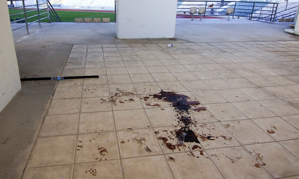 Τελικός Κυπέλλου: Σοκάρουν οι εικόνες με τα αίματα στο Πανθεσσαλικό!