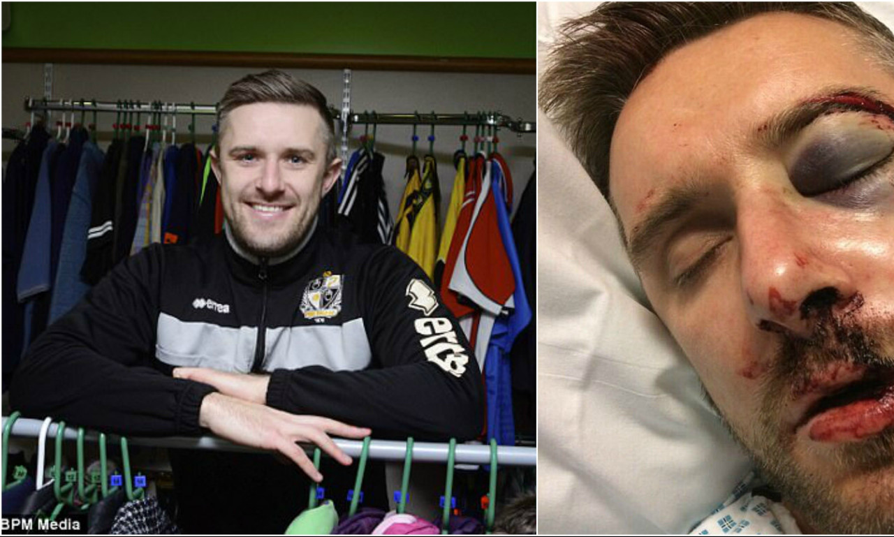 Απίστευτο: Χτύπησε σε αγώνα κι έγινε… ΕΤΣΙ! (photos)