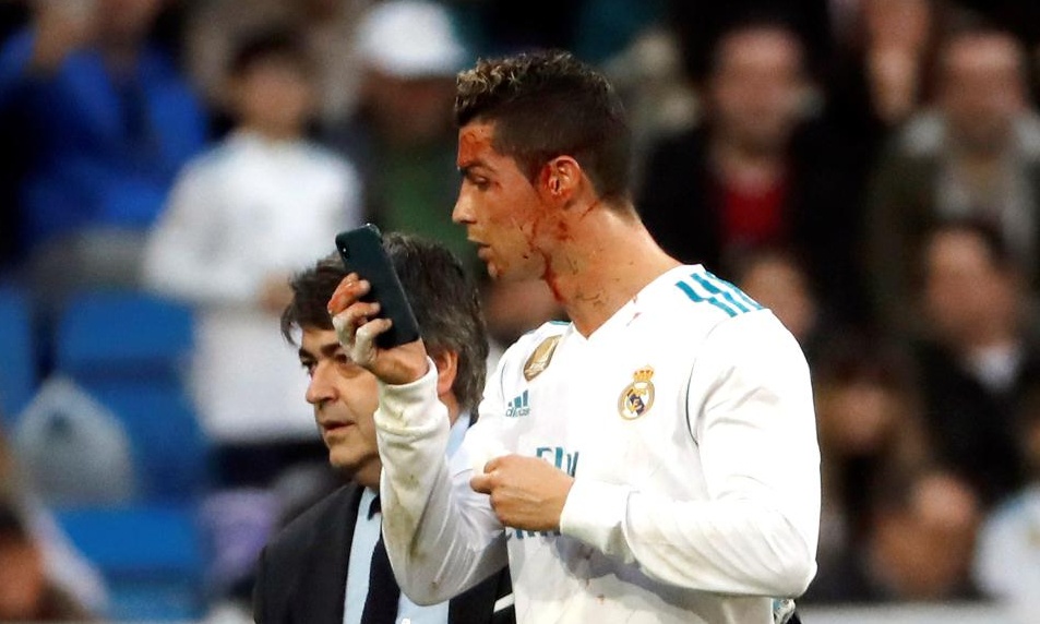 Θεός! Τραυματίστηκε ο Ρονάλντο και έβγαζε φωτογραφίες με το κινητό του γιατρού (photos+videos)