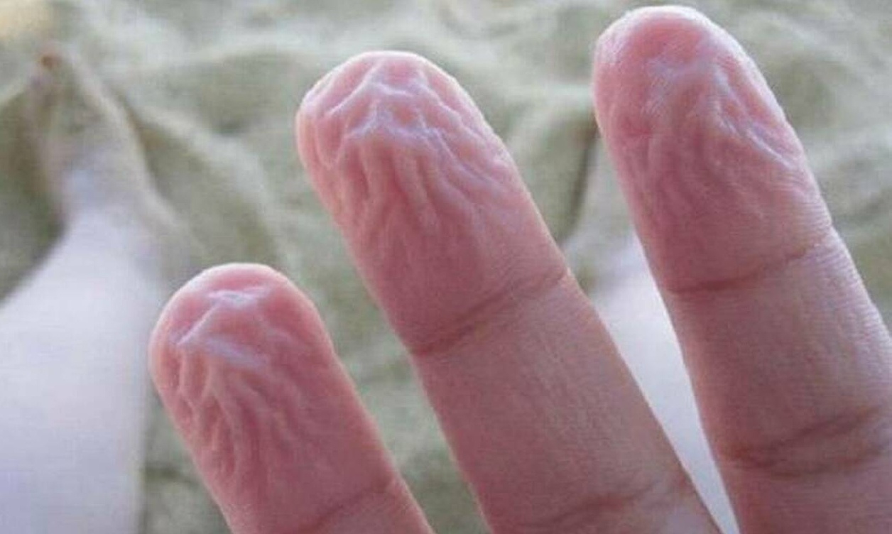 Εννιά παράξενα πράγματα που κάνει το σώμα σου και δεν γνωρίζεις το λόγο!