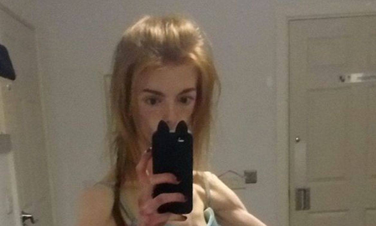 Έφτασε κοντά στο θάνατο ζυγίζοντας 30 κιλά και την έσωσε η… σοκολάτα (photos)