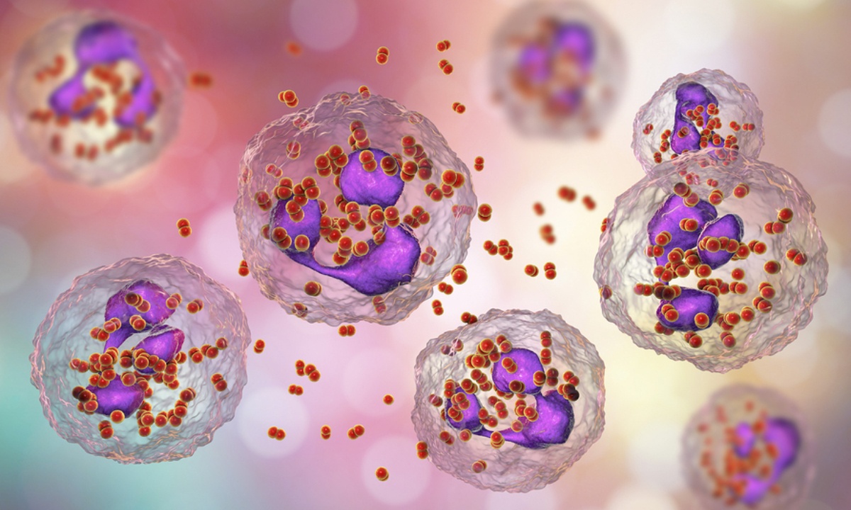 Γονόρροια: Τα συμπτώματα που δεν πρέπει να αγνοήσετε (εικόνες)