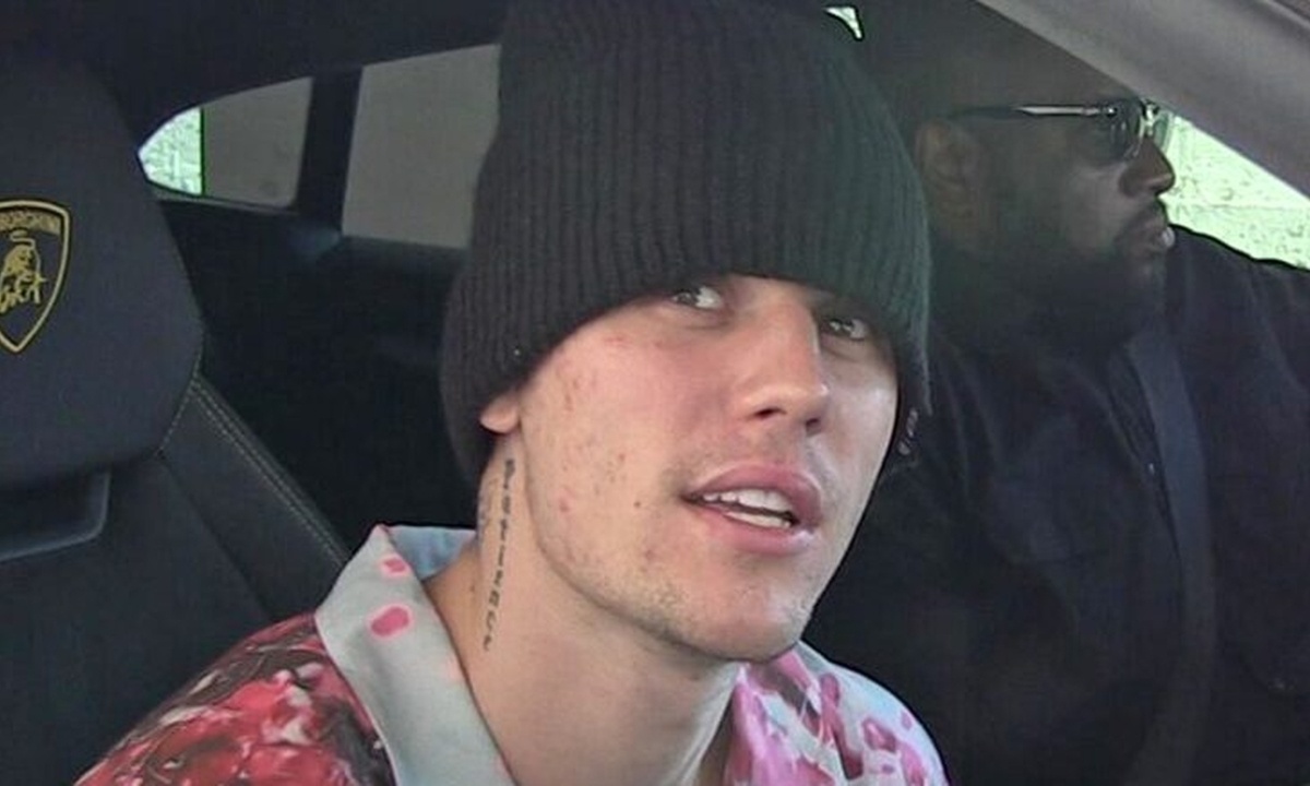 Justin Bieber: Θρίλερ με την υγεία του- Η ασθένεια από την οποία πάσχει και το μήνυμά του