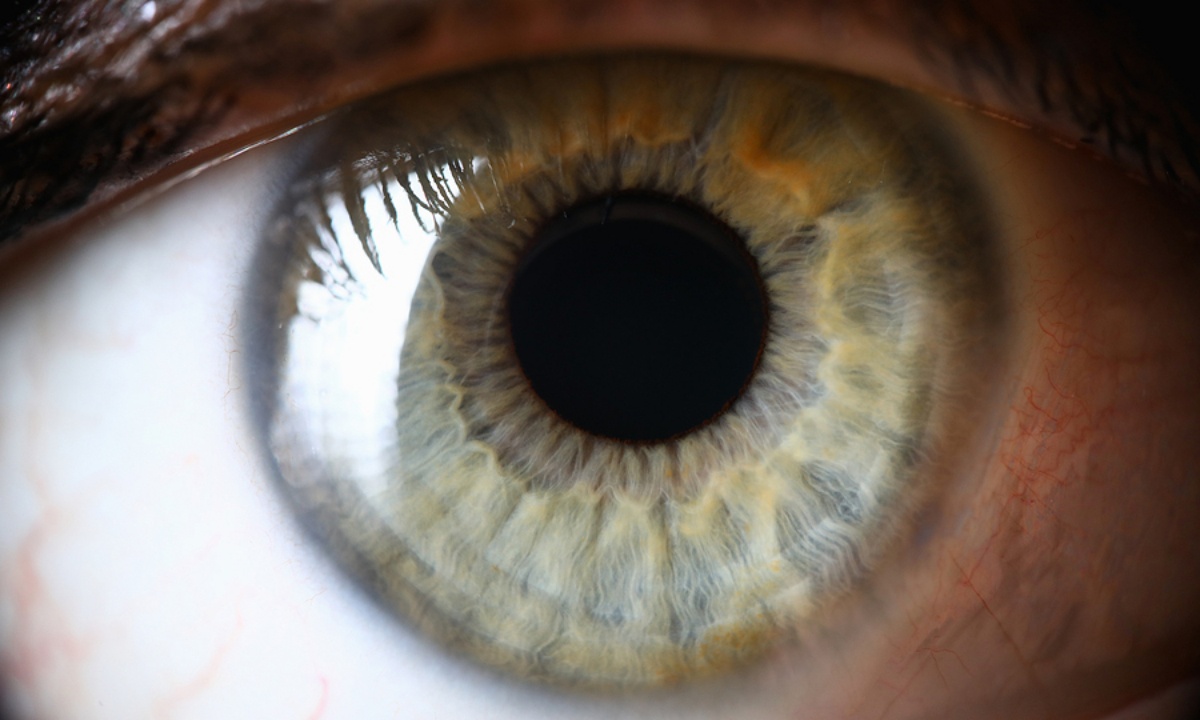 Αποκόλληση αμφιβληστροειδούς: Οι βασικοί παράγοντες κινδύνου σε εικόνες